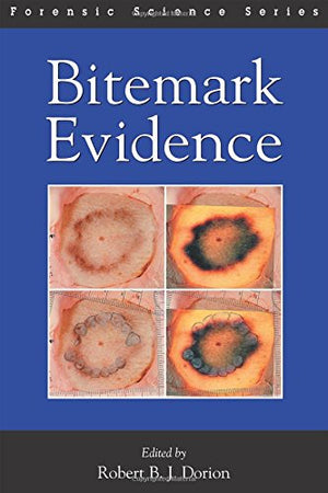 BITEMARK EVIDENCE