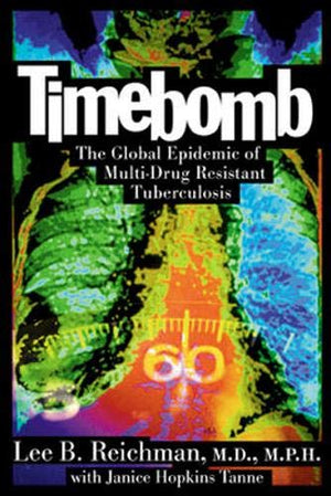 TIMEBOMB
