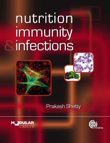 NUTRITION IMMUNITY INFECTION