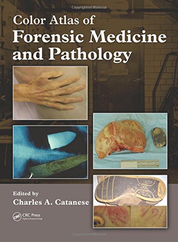 COLOR ATLAS OF FORENSIC MEDICINE AND PATHOLOGY