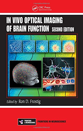 IN VIVO OPTICAL IMAGING OF BRAIN FUNCTION