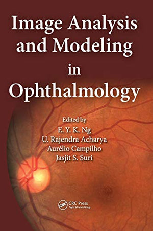 IMAGE ANALYSIS AND MODELING IN OPHTHALMOLOGY