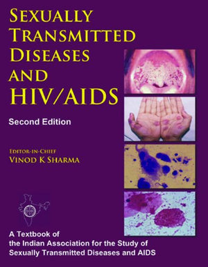 SEXUALLY TRANSMITTED DISEASES AND HIV/AIDS