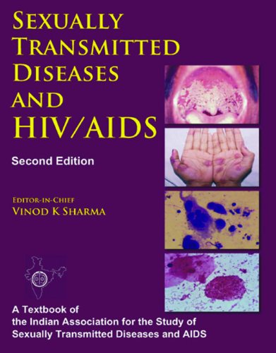 SEXUALLY TRANSMITTED DISEASES AND HIV/AIDS
